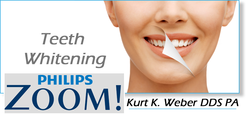 Teeth Whitening Service Promotion